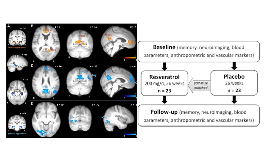 Effects of Resveratrol on Memory Performance (…)