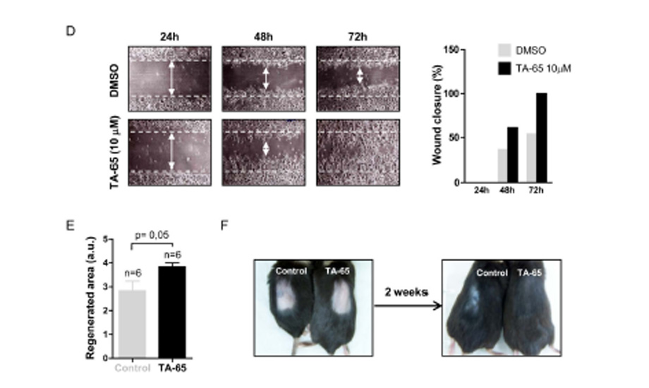 The telomerase activator TA-65 (…)