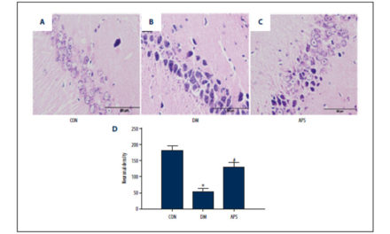 Neuroprotective Effect of Astragalus Polysacharin (…)