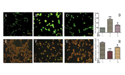 Resveratrol Suppresses Rotenoneinduced Neurotoxicity (…)