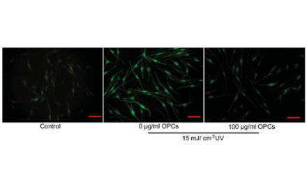 Oligomeric proanthocyanidins from grape seeds Effectively inhibit ultraviolet-induced melanogenesis (…)