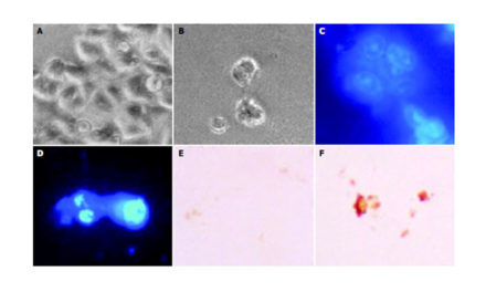 Anticancer effects of oligomeric proanthocyanidins (…)