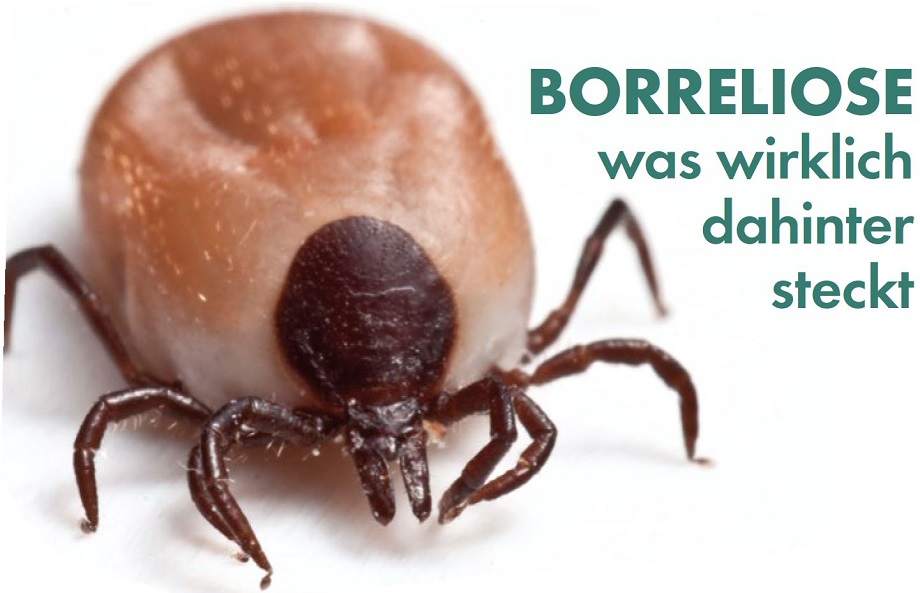 BORRELIOSE was wirklich dahinter steckt