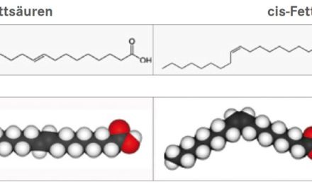 TRANSFETTSÄUREN – Aus ernährungsmedizinischer Sicht