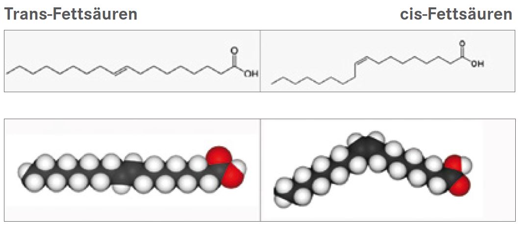 TRANSFETTSÄUREN – Aus ernährungsmedizinischer Sicht